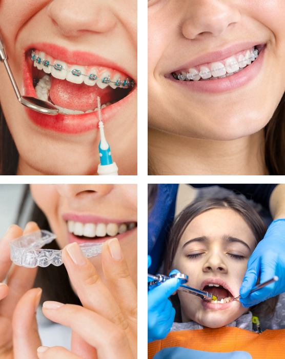 Teeth Treatments